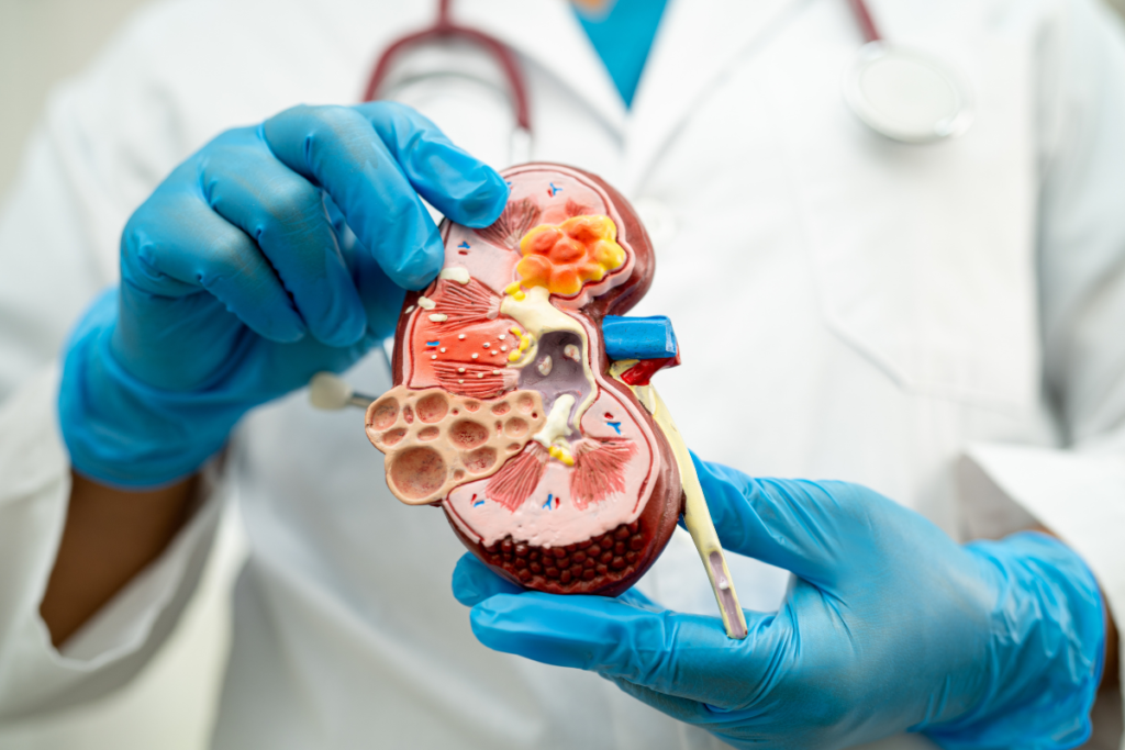 why-does-creatinine-increase-after-kidney-transplant-renal